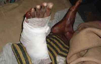 চট্রগ্রাম বিশ্ববিদ্যালয়ে ছাত্রলীগ নেতার হাত-পায়ের রগ কাটলো শিবির